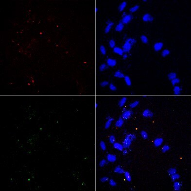 Human/Canine NGFR/TNFRSF16 Antibody MAB367