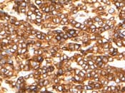 Human  alpha 1‑Acid Glycoprotein Antibody MAB3694