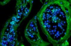 Human c‑Myc Antibody MAB3696