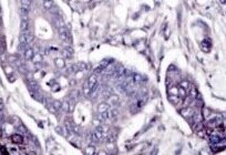 Mouse Wnt‑11 Antibody MAB3746