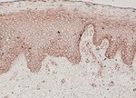 Human CCL27/CTACK Antibody MAB3761