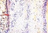 Human CCL27/CTACK Antibody MAB376