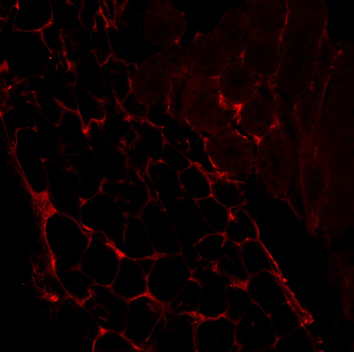 Human Vitamin D BP Antibody MAB3778
