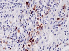 Human CD8 alpha  Antibody MAB3804