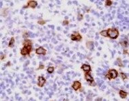 Human Aminopeptidase N/CD13 Antibody MAB3815