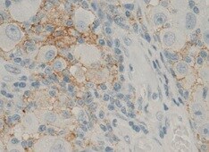 Human Stabilin‑1 Antibody MAB3825