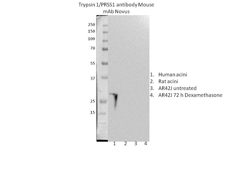 Human Trypsin 1/PRSS1 Antibody MAB3848