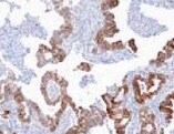 Human/Mouse Plexin C1 Antibody MAB3887