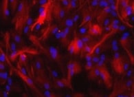 Mouse Thrombomodulin/BDCA‑3 Antibody MAB3894
