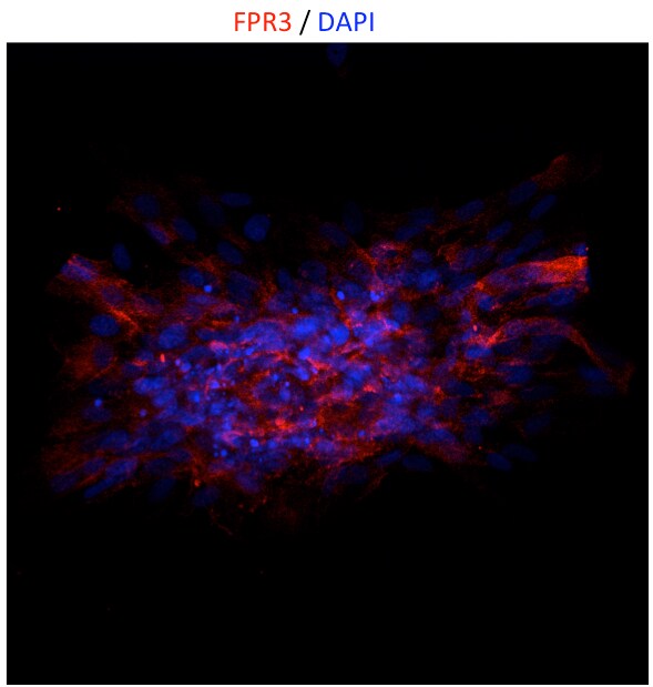Human FPRL2/FPR3 Antibody MAB3896