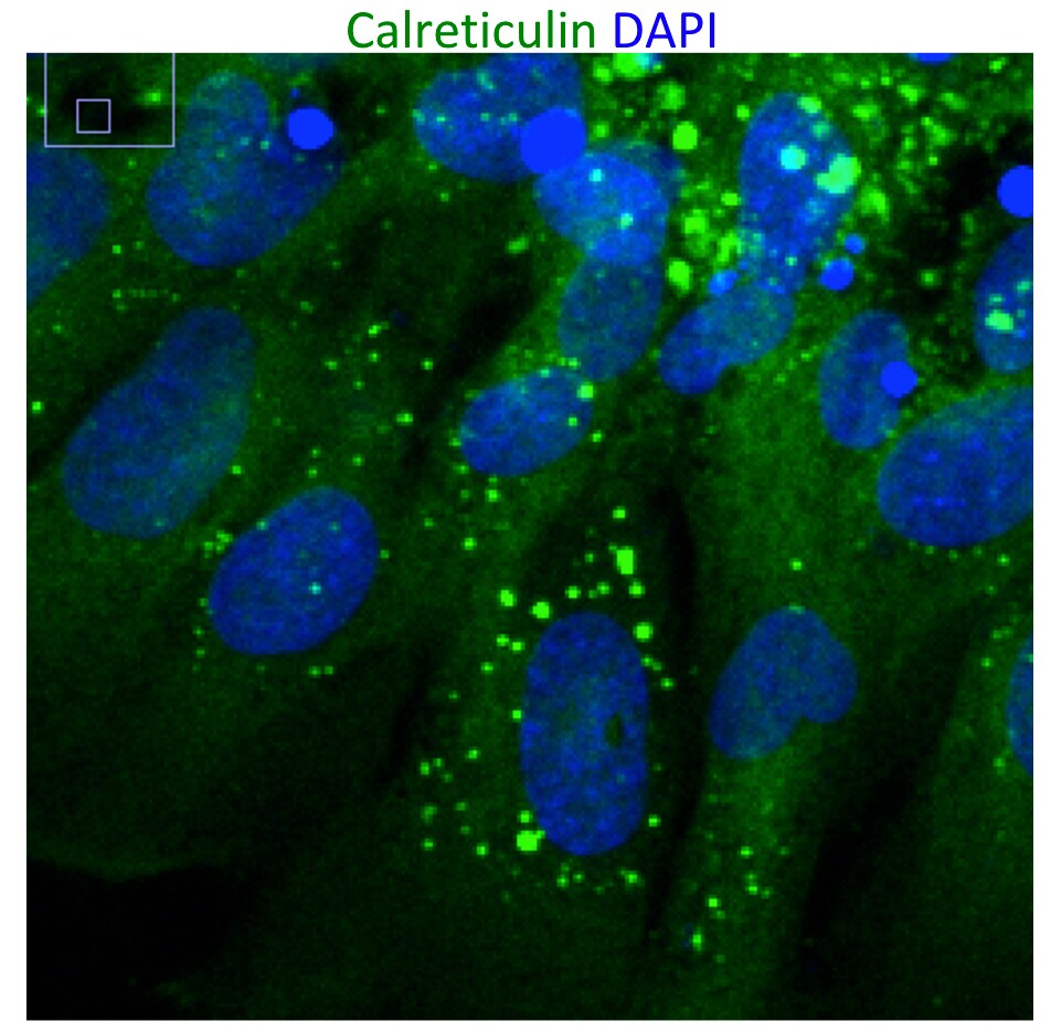 Human Calreticulin Antibody MAB3898