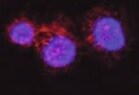 Human IRAK4 Antibody MAB39191