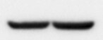 Human/Mouse IGF-I R/IGF1R Antibody MAB391