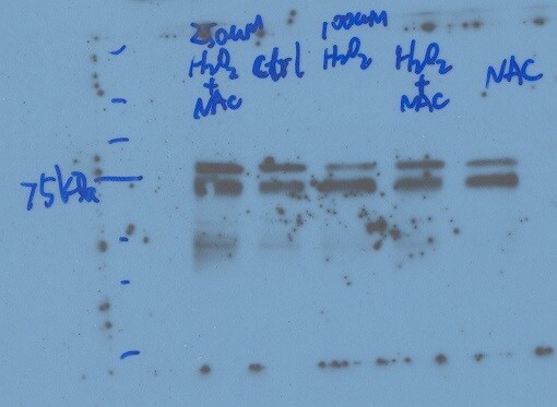 Human Nrf2 Antibody MAB3925