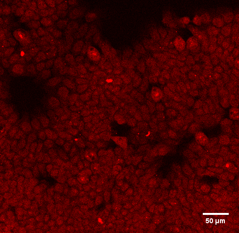 Human Nrf2 Antibody MAB3925