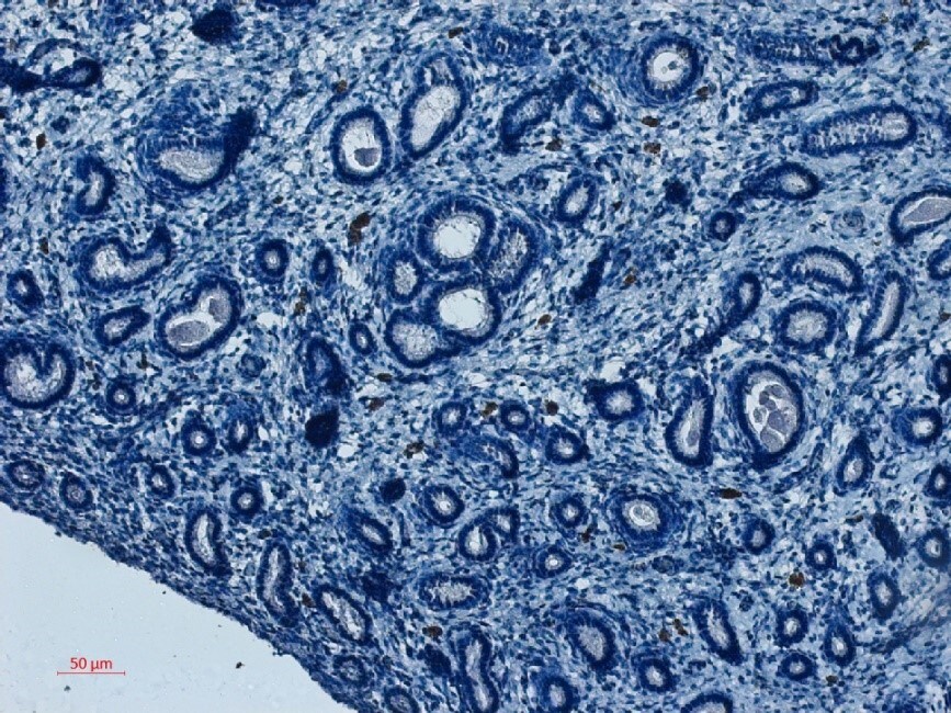 Human VAP‑1/AOC3 Antibody MAB3957