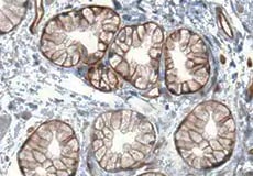 Mouse Integrin  beta 4/CD104 Antibody MAB4054