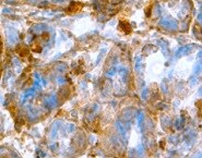 Human TFF2 Antibody MAB4077