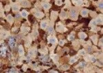 Human Apolipoprotein B/ApoB Antibody MAB4124