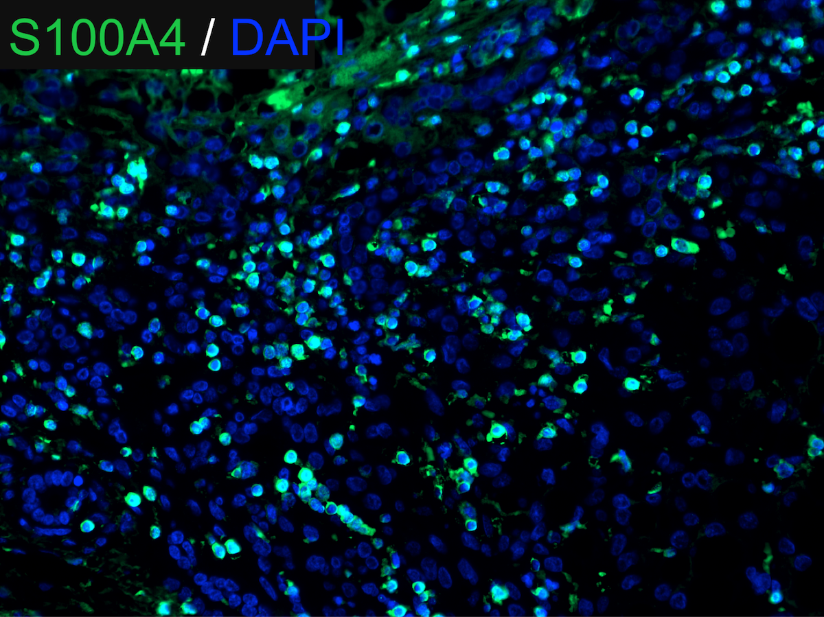 Human S100A4 Antibody MAB4137