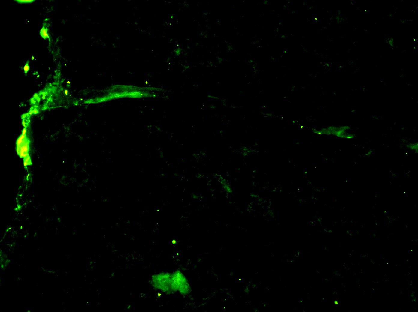 Human S100A4 Antibody MAB4137