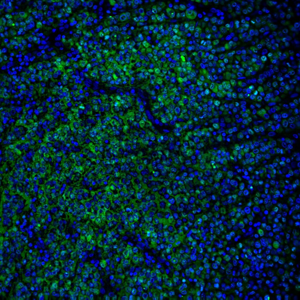 Human S100A4 Antibody MAB4137