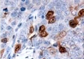 Human S100A4 Antibody MAB4137
