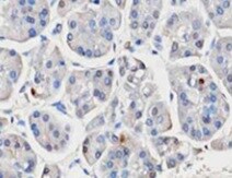 Human Serpin B8/Proteinase Inhibitor 8 Antibody MAB4158