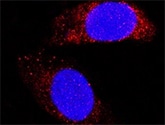 Human Laminin  alpha 1 Antibody MAB4187