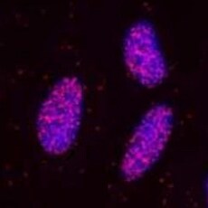 Human Phospho-STAT5a/b (Y694/Y699) Antibody MAB4190