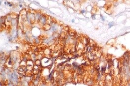 Human COX‑2 Antibody MAB4198