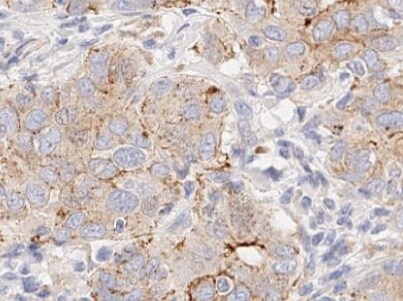 Human COX‑2 Antibody MAB4198