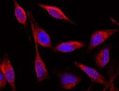 Human ESAM Antibody MAB4204
