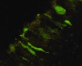 Human Uteroglobin/SCGB1A1 Antibody MAB4218