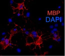 Human/Mouse/Rat MBP Antibody MAB42282