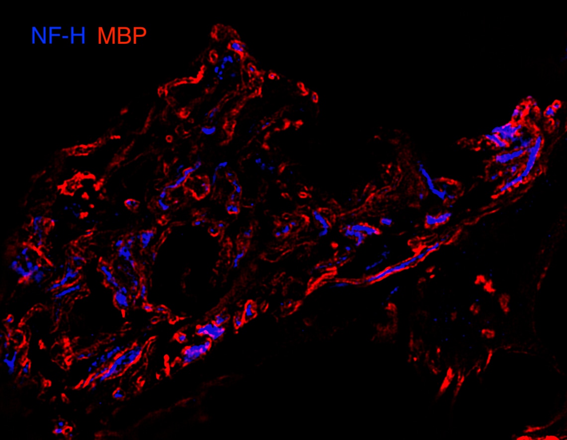 Human/Mouse/Rat MBP Antibody MAB42282