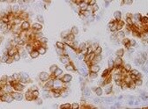 Human/Mouse/Rat Jak1 Antibody MAB4260