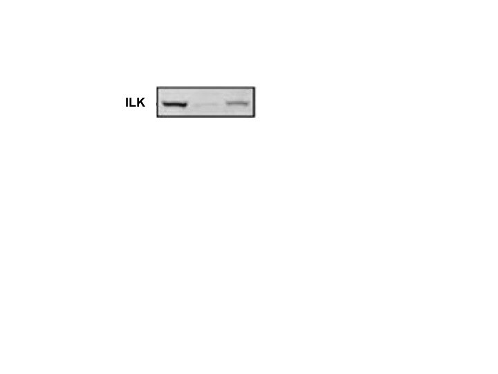 Human/Mouse/Rat ILK Antibody MAB4266