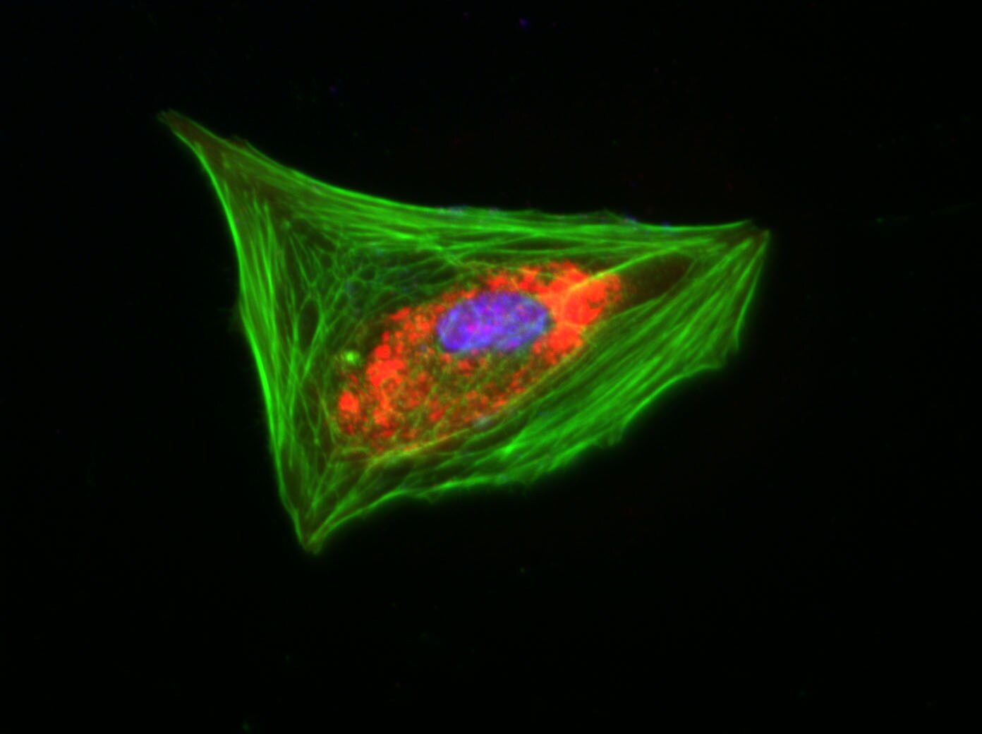 Human/Mouse/Rat ILK Antibody MAB4266