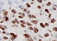 Mouse Serum Amyloid A4 Antibody MAB4276