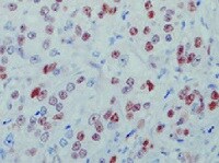 Human Cyclin D1 Antibody MAB4314