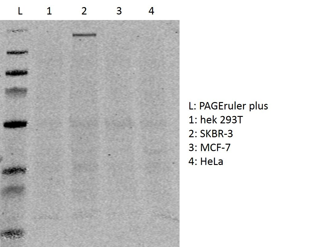 Human ErbB2/Her2 Herstatin Isoform Antibody MAB4360
