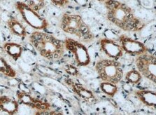 Human Mineralocorticoid R/NR3C2 Antibody MAB4369