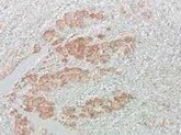 Human Trefoil Factor 3 Antibody MAB4407