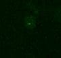 Human TFF3 Antibody MAB4408