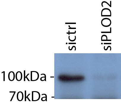 Human Lysine Hydroxylase 2/PLOD2 Antibody MAB4445