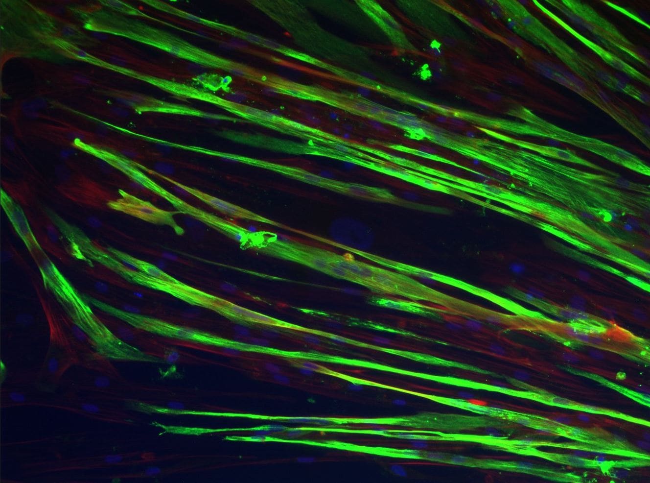 Myosin Heavy Chain Antibody MAB4470