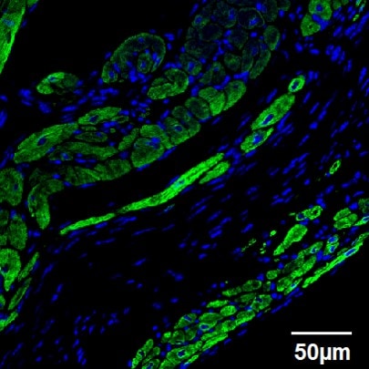 Myosin Heavy Chain Antibody MAB4470