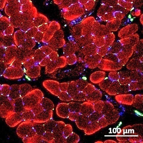 Myosin Heavy Chain Antibody MAB4470