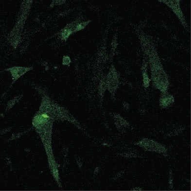 Myosin Heavy Chain Antibody MAB4470
